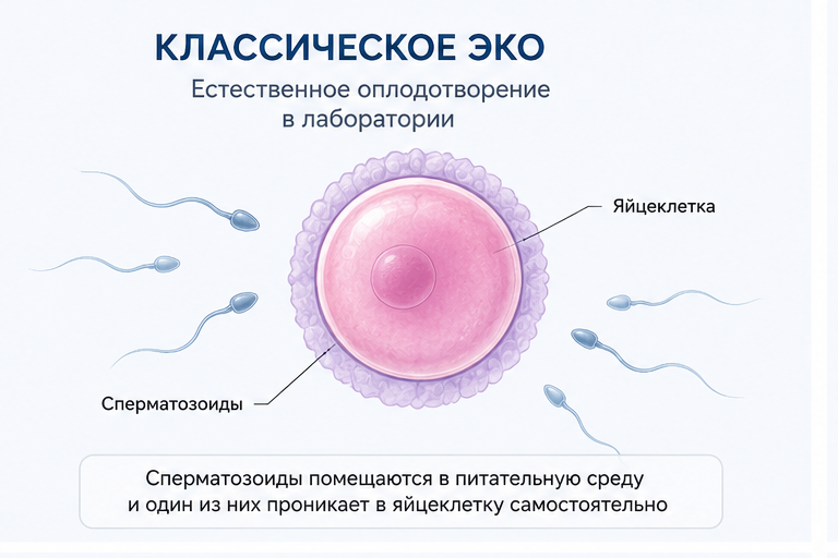 Классическое ЭКО: естественное оплодотворение яйцеклетки в лаборатории